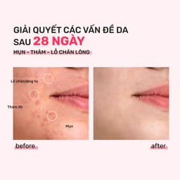 Thumbnail Bộ Đôi Toner Derladie 500ml, Serum Derladie Laboratoire Pore Tightening Ampoule Niacinamide 20% + Zic PCA 1% 30 2