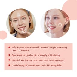 Thumbnail Combo Sạch Da  Acne Pimple Master Patch 24 Miếng + Sữa Rửa Mặt Low Ph Good Morning 50ml 4