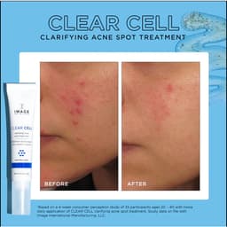 Thumbnail Gel chấm mụn và giảm viêm cấp tốc IMAGE Skincare Clear Cell Clarifying Salicylic Blemish Gel 14g (new) 3