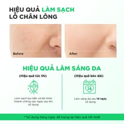 Thumbnail Combo sữa rửa mặt Oribe 100g và kem chấm mụn 20g sạch sâu dịu nhẹ giảm mụn ẩn 3
