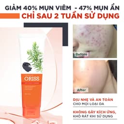 Thumbnail Sữa rửa mặt ngừa mụn Oriss dưỡng ẩm tẩy tế bào chết thu nhỏ lỗ chân lông 100g 3