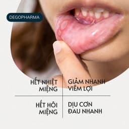 Thumbnail Xịt Dứt Điểm Nhiệt Miệng, Nhiệt lưỡi, Lở môi, Viêm Lợi Dego Pharma - Dịu Cơn Đau Loét Miệng, Hết Hôi Miệng 4