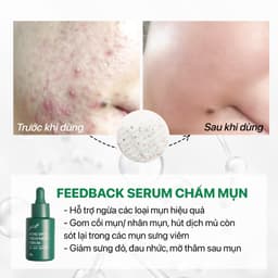 Thumbnail Serum giảm mụn, mờ thâm BHA 1%+AHA 2%+tràm trà, giảm sợi bã nhờn hiệu quả GUO 30ml 4