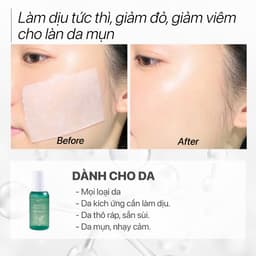 Thumbnail Toner tràm cúc kiềm dầu, cấp ẩm, ngừa mụn, cân bằng, dịu nhẹ cho da nhạy cảm GUO 100ml 4
