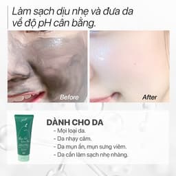 Thumbnail Sữa Rửa Mặt Than Tre Tràm Trà sạch mụn kiềm dầu không SLS, dịu nhẹ cho nhạy cảm pH 5.5 GUO 4