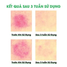 Thumbnail Tinh Chất Rau Má Cấp Ẩm Làm Dịu Da Ample:N Centel Calming Shot Ampoule 4