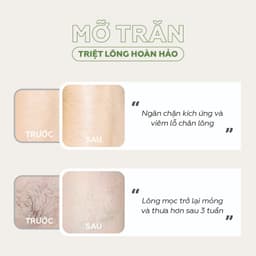 Thumbnail Triệt lông mỡ trăn UMIHA (30ml) - Ức chế mọc lông sau với Mỡ trăn triệt lông sau khi dùng Kem tẩy lông và Sáp Wax lông 3