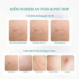 Thumbnail Tẩy Trang Thuần Chay Sạch Dịu Êm Cho Da Dầu Mụn Derladie Cleansing Water Witch Hazel Micellar Unsented 500ML 1