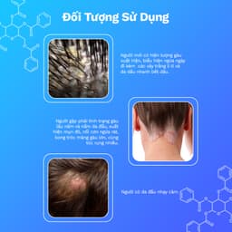 Thumbnail Combo dầu gội và dầu xả dành riêng cho tóc gàu nấm ngứa Biocarepharma. 3