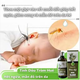 Thumbnail Tinh Dầu Tràm Hồng Tâm Nguyên Chất 100ml Hỗ Trợ Thơm Phòng, Đuỗi Muỗi, Phòng Cảm Cho Bé Yêu 3