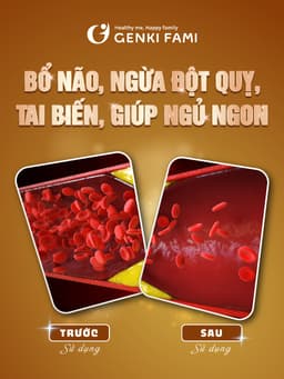 Thumbnail Viên Uống Bổ Não, Ngừa Đột Quỵ Tai Biến, Giúp Ngủ Ngon Nattokinase 3000FU Natto Ichou Genki Fami Nhật Bản 4