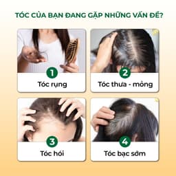 Thumbnail Dầu Gội Thảo Dược Hà Thủ Ô 2in1 Cỏ Cây Hoa Lá 420g - DƯỠNG ẨM CHO TÓC ĐEN MỀM MƯỢT 2