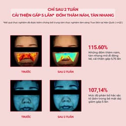 Thumbnail Kem Dưỡng Giảm Thâm Nám Chuyên Biệt Angel's Liquid Tranexamic Mela Zero Cream 50ml (ĐỎ) 4