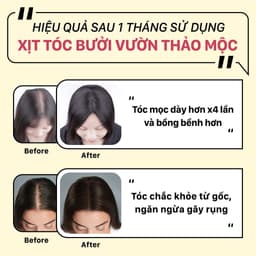 Thumbnail Xịt tóc kích mọc tóc MAKYN 50ml - Xịt bưởi giúp ngăn rụng tóc, dưỡng tóc, chăm sóc tóc và phục hồi tóc tư tổn 3