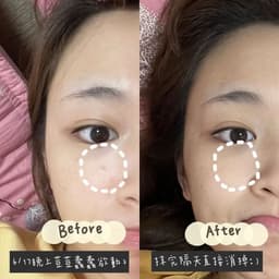 Thumbnail Gel giảm mụn kháng khuẩn & làm dịu da Sebamed Clear Face Anti-Pimple pH5.5 (10ml) 4