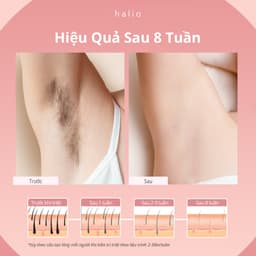 Thumbnail [SPLIVE] Máy Triệt Lông Băng Lạnh Trẻ Hóa Da Halio IPL Cooling Hair Removal Device 4
