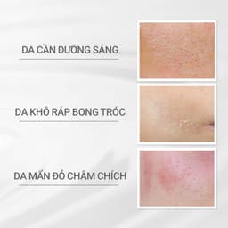 Thumbnail Sữa dưỡng trắng cho da nhạy cảm Dprogram Microbiome Brightening Clear Emulsion 100ml 2