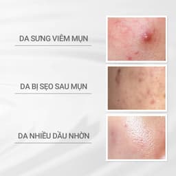Thumbnail Nước cân bằng cho da mụn Dprogram Microbiome Acne care Lotion 125ml 3