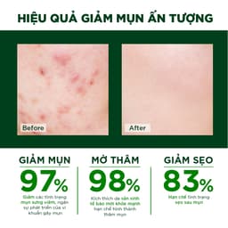Thumbnail Combo kem chấm mụn Oribe & kem nghệ Oriss giúp giảm mụn mờ thâm 2