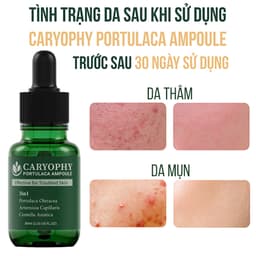 Thumbnail Bộ chăm sóc da mụn Caryophy portulaca (serum 30ml toner 300ml) 3