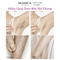 Thumbnail Kem tẩy lông BLANICA Hair Removal Cream tẩy sạch lông vùng kín, tay, chân, nách an toàn, không đau rát 120g 4