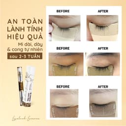 Thumbnail Tinh chất dưỡng mi dài cong chỉ sau 2 TUẦN MACALAND 5ml/10ml từ Mầm Đậu Xanh, Cỏ Ba Lá Đỏ, Dầu Mắc Ca 3