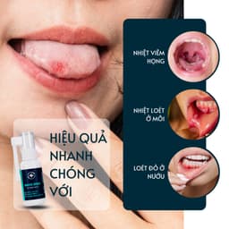 Thumbnail Xịt Dứt Điểm Nhiệt Miệng, Nhiệt lưỡi, Lở môi, Viêm Lợi Dego Pharma - Dịu Cơn Đau Loét Miệng, Hết Hôi Miệng 2