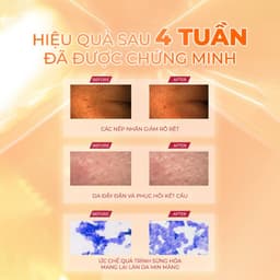 Thumbnail Serum Niacinamide 15% Trắng Da Se Khít Lỗ Chân Lông Medi Shot NA15 MEISHOKU 30ml 4