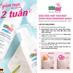 Thumbnail Combo 2 chai Sữa rửa mặt tạo bọt kháng khuẩn giảm mụn Sebamed Cleansing Foam pH5.5 (150ml) 3