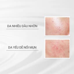 Thumbnail Sữa dưỡng cho da dầu/hỗn hợp nhạy cảm Dprogram Microbiome Balance Care Emulsion 100ml 2