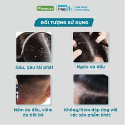 Thumbnail Dầu gội sạch gàu hết ngứa Novocare - Freeskin Anti - Dandruff & Itching 220ml 4