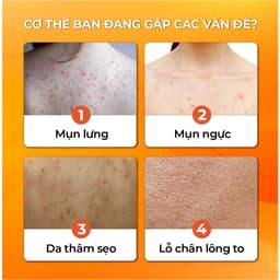 Thumbnail Sữa Tắm Thảo Dược Gừng Nghệ Cỏ Cây Hoa Lá - Làm Sạch Sâu Mờ Thâm Mụn - 500g 3