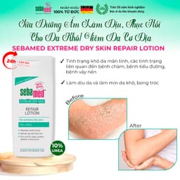 Thumbnail Sữa dưỡng thể dưỡng ẩm, giảm khô ngứa, bong tróc cho da khô viêm cơ địa Sebamed Dry Lotion 200ml 2
