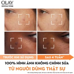 Thumbnail Combo 2: Kem Dưỡng Ẩm Ban Đêm OLAY LUMINOUS + Super Serum OLAY LUMINOUS NIACINAMIDE VITAMIN C (50G + 30ML) 4