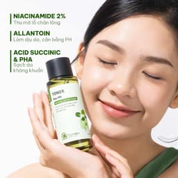 Thumbnail Active Toner Dưỡng Ẩm Ngừa Mụn Rau Má Dành Cho Da Mụn Da Dầu Nhạy Cảm Cỏ Mềm 150ml 1