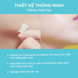 Thumbnail Combo Dán Mụn Day Plus (Salicylic Acid) & Night Derma Angel 12 Miếng x 2 4
