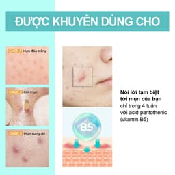 Thumbnail Kem Dưỡng ẩm, Giảm Dầu Mụn Numbuzin No.1 Pantothenic B5 Active Soothing Cream 80ml 2