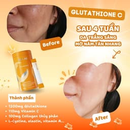 Thumbnail Bột uống BB LAB Glutathione 1200mg và Vitamin C 110mg Làm Trắng Da, Mờ Nám, Giảm Thâm Mụn Hộp /30 Gói 2