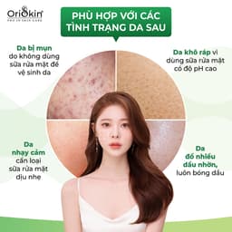 Thumbnail Sữa Rửa Mặt Cho Da Dầu Mụn Oriskin Cleanser Moisturizing 60ml 3