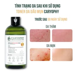 Thumbnail Toner da dầu mụn Caryophy Portulaca Hàn Quốc cấp ẩm ngừa mụn không cồn 300ml 4