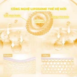 Thumbnail Mặt Nạ Phục Hồi Da Xỉn Màu BNBG Vita Genic Whitening Jelly Mask 30ml (Miếng lẻ) 2