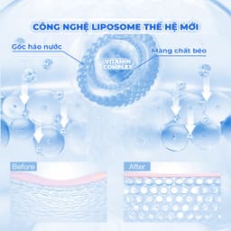 Thumbnail Combo 20 Mặt Nạ BNBG Hỗ Trợ Dưỡng Ẩm, Cấp Nước BNBG Hydrating Vita Genic Jelly Mask 30mlx20 4
