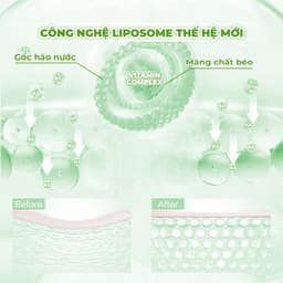 Thumbnail Mặt Nạ Phục Hồi Da Tổn Thương BNBG Vita Genic Relaxing Jelly Mask 30ml (Miếng lẻ) 3