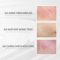 Thumbnail [KOL LIVE] Kem dưỡng Phục hồi da dProgram Skin Repair Cream 45g 2