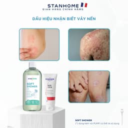 Thumbnail Combo sữa tắm, rửa mặt và kem dưỡng ẩm phục hồi viêm da cơ địa, chàm vảy nến, bong tróc Stanhome Soft Shower-Sos Cica 1