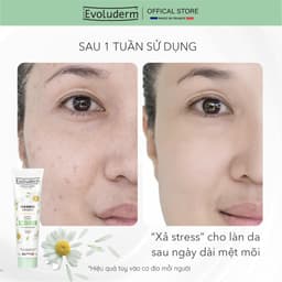 Thumbnail Tẩy tế bào chết dành cho mặt Evoluderm 150ml 4
