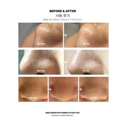 Thumbnail Ủ Mụn Đầu Đen Mụn Đầu Trắng Làm Sạch Sâu Kiểm Soát Bã Nhờn Heextein Deep Sebum 1000ml 2