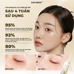 Thumbnail Sample Kem Mắt Bọc Vàng Cải Thiện 4 Vấn đề Vùng Da Mắt SURMEDIC Perfection 100tm All In One Facial Eye Cream 1ml 3