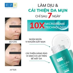 Thumbnail Serum dưỡng ẩm cho da mụn, nhạy cảm Hada Labo Acne Care Calming Serum 30ml 4
