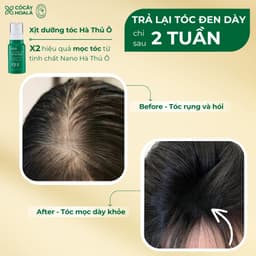 Thumbnail XỊT DƯỠNG TÓC THẢO DƯỢC HÀ THỦ Ô ĐỎ CỎ CÂY HOA LÁ 100G - CẢI THIỆN GÃY RỤNG 2